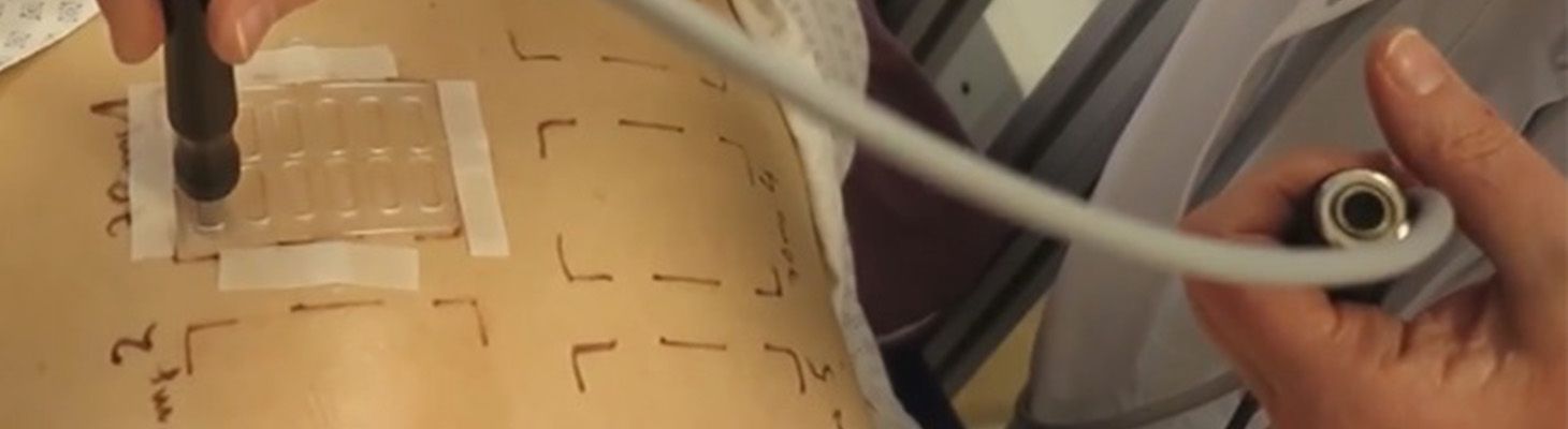 Foto de noticia: Innovación en in-vivo SPF Testing: el método LED-HDRS se consolida como una alternativa precisa, reproducible y no invasiva